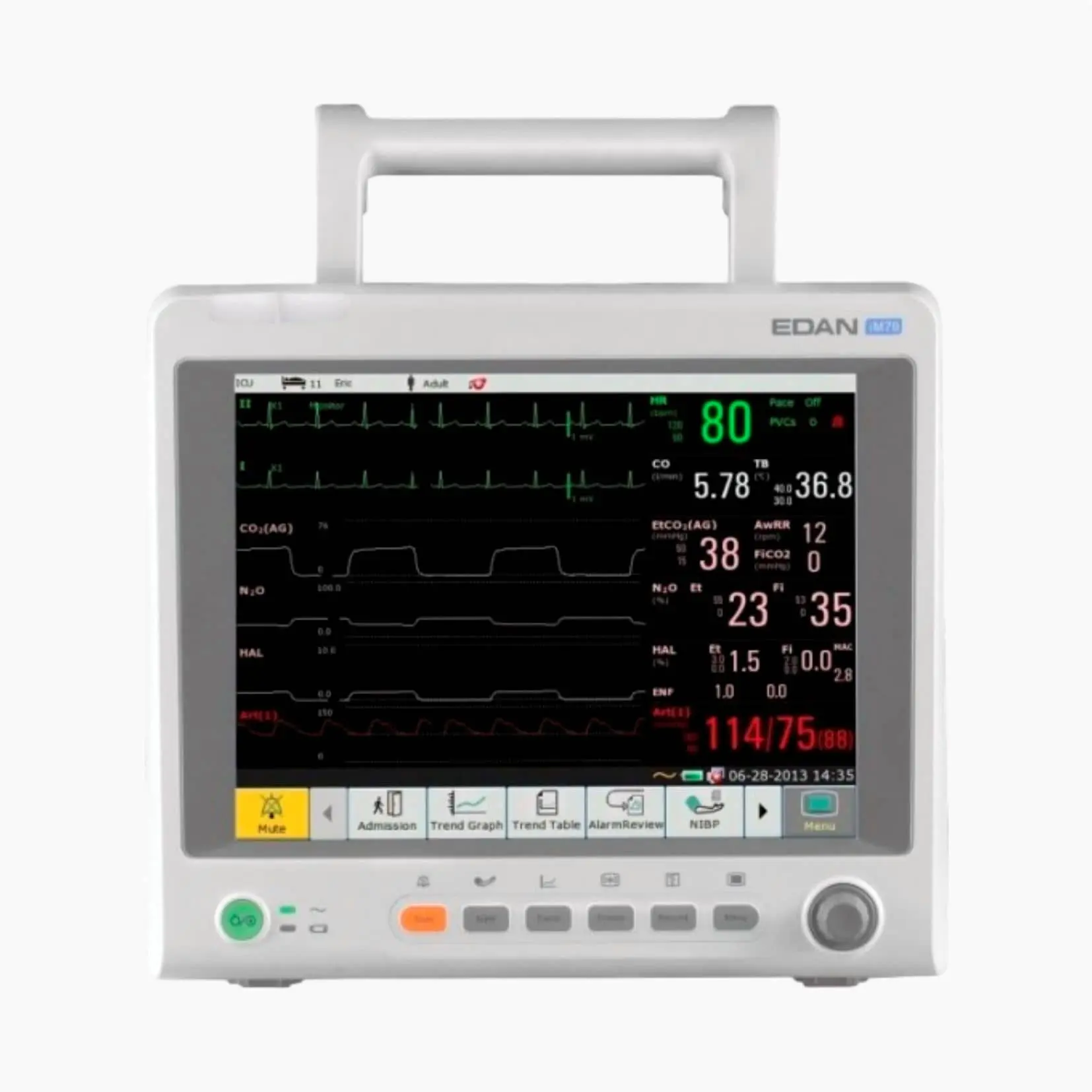 149 MONITOR DE PACIENTE IM70 - BÁSICO - Imagen 1