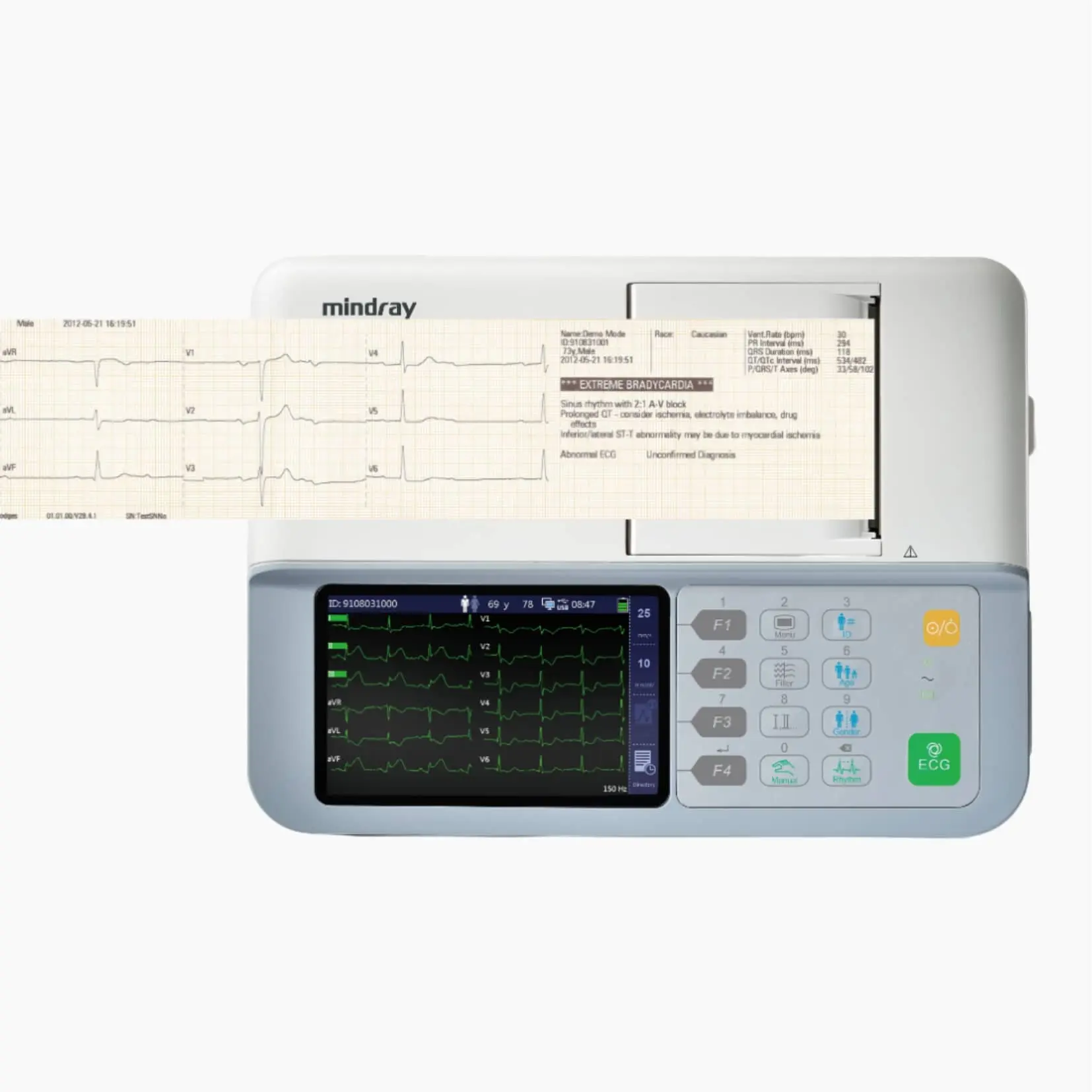 204 ELECTROCARDIÓGRAFO BENEHEART R3 - Imagen 1